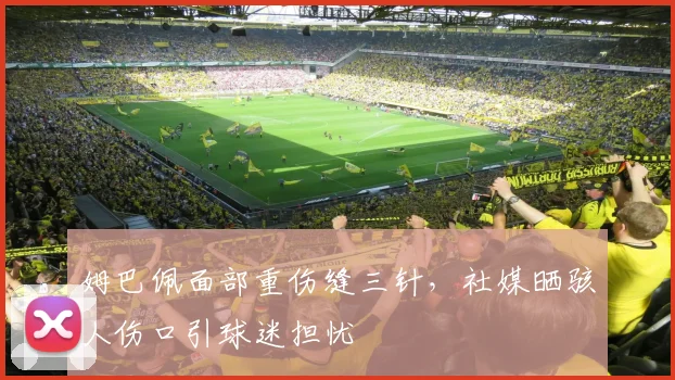姆巴佩面部重伤缝三针，社媒晒骇人伤口引球迷担忧